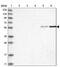 Required For Meiotic Nuclear Division 1 Homolog antibody, PA5-56730, Invitrogen Antibodies, Western Blot image 