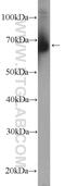 Zinc Finger Protein 90 antibody, 26120-1-AP, Proteintech Group, Western Blot image 