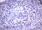 Hdm2 antibody, LS-C175690, Lifespan Biosciences, Immunohistochemistry paraffin image 