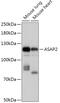 ArfGAP With SH3 Domain, Ankyrin Repeat And PH Domain 2 antibody, 16-991, ProSci, Western Blot image 