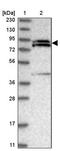 OPA1 Mitochondrial Dynamin Like GTPase antibody, PA5-57875, Invitrogen Antibodies, Western Blot image 