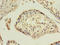 HAVcr-1 antibody, LS-C370700, Lifespan Biosciences, Immunohistochemistry paraffin image 