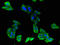 ATP Binding Cassette Subfamily B Member 9 antibody, LS-C502060, Lifespan Biosciences, Immunofluorescence image 