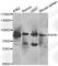 Bruton Tyrosine Kinase antibody, A1576, ABclonal Technology, Western Blot image 