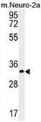 Zinc Finger CCCH-Type Containing 8 antibody, AP54623PU-N, Origene, Western Blot image 