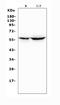 Cytochrome P450 Family 2 Subfamily A Member 6 antibody, A00947-2, Boster Biological Technology, Western Blot image 