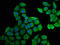 Hydroxysteroid 17-Beta Dehydrogenase 1 antibody, LS-C669592, Lifespan Biosciences, Immunofluorescence image 