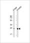 Neurotrophin 3 antibody, GTX81308, GeneTex, Western Blot image 