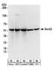 SEC62 Homolog, Preprotein Translocation Factor antibody, A303-981A, Bethyl Labs, Western Blot image 