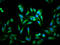 Acyl-CoA Thioesterase 1 antibody, LS-C674637, Lifespan Biosciences, Immunofluorescence image 