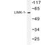 LIM domain kinase 1 antibody, LS-C176780, Lifespan Biosciences, Western Blot image 