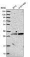 Glycine N-acyltransferase antibody, PA5-65261, Invitrogen Antibodies, Western Blot image 