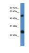 Src Like Adaptor 2 antibody, NBP1-79829, Novus Biologicals, Western Blot image 
