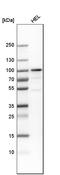 Zinc Finger And BTB Domain Containing 16 antibody, HPA001499, Atlas Antibodies, Western Blot image 