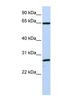 DnaJ Heat Shock Protein Family (Hsp40) Member C1 antibody, NBP1-62602, Novus Biologicals, Western Blot image 