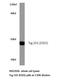 Tumor Susceptibility 101 antibody, LS-C176945, Lifespan Biosciences, Western Blot image 