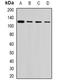 Ubiquitin Specific Peptidase 26 antibody, orb382116, Biorbyt, Western Blot image 