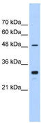 Cytochrome P450 Family 2 Subfamily C Member 9 antibody, TA346225, Origene, Western Blot image 