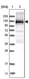 EMAP Like 4 antibody, PA5-57771, Invitrogen Antibodies, Western Blot image 