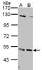 Interferon alpha/beta receptor 2 antibody, NBP1-31665, Novus Biologicals, Western Blot image 