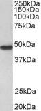 Par1 antibody, GTX88425, GeneTex, Western Blot image 