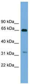 UBX Domain Protein 10 antibody, TA338832, Origene, Western Blot image 