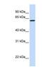 DiGeorge Syndrome Critical Region Gene 2 antibody, NBP1-59220, Novus Biologicals, Western Blot image 