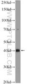 SMAD Family Member 7 antibody, 25840-1-AP, Proteintech Group, Western Blot image 