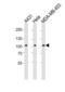 EPHB1 antibody, LS-C100280, Lifespan Biosciences, Western Blot image 