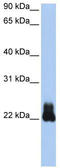 Rho-related GTP-binding protein RhoD antibody, TA344099, Origene, Western Blot image 