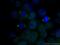 Matrix Metallopeptidase 13 antibody, 18165-1-AP, Proteintech Group, Immunofluorescence image 