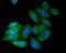 NADH:Ubiquinone Oxidoreductase Subunit A13 antibody, NBP2-75517, Novus Biologicals, Immunocytochemistry image 