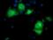 Pyrroline-5-Carboxylate Reductase 3 antibody, MA5-25319, Invitrogen Antibodies, Immunocytochemistry image 