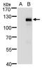 Myocardin Related Transcription Factor A antibody, GTX129372, GeneTex, Western Blot image 