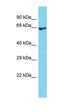 Rho Guanine Nucleotide Exchange Factor 4 antibody, orb326286, Biorbyt, Western Blot image 