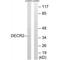 2,4-Dienoyl-CoA Reductase 2 antibody, A11948, Boster Biological Technology, Western Blot image 