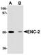 Ectoderm-neural cortex protein 1 antibody, PA5-20936, Invitrogen Antibodies, Western Blot image 