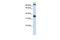 Ferric Chelate Reductase 1 Like antibody, GTX46376, GeneTex, Western Blot image 