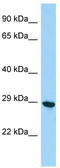 PHD Finger Protein 7 antibody, TA329860, Origene, Western Blot image 