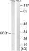 Carbonyl Reductase 1 antibody, TA311915, Origene, Western Blot image 