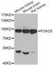 Forkhead Box O3 antibody, A0102, ABclonal Technology, Western Blot image 