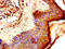 Late Cornified Envelope 1B antibody, orb45938, Biorbyt, Immunohistochemistry paraffin image 