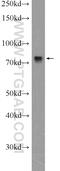 DEF6 Guanine Nucleotide Exchange Factor antibody, 11369-1-AP, Proteintech Group, Western Blot image 