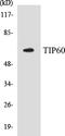 Lysine Acetyltransferase 5 antibody, EKC1567, Boster Biological Technology, Western Blot image 