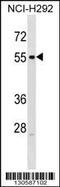 Relaxin Family Peptide Receptor 3 antibody, 60-333, ProSci, Western Blot image 
