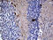 Proto-oncogene DBL antibody, M05775, Boster Biological Technology, Immunohistochemistry paraffin image 