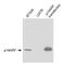 Cyclin Dependent Kinase Inhibitor 2A antibody, NB200-158, Novus Biologicals, Western Blot image 
