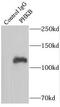Phosphorylase Kinase Regulatory Subunit Beta antibody, FNab06393, FineTest, Immunoprecipitation image 