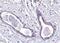 Abraxas 1, BRCA1 A Complex Subunit antibody, PA5-20412, Invitrogen Antibodies, Immunohistochemistry paraffin image 