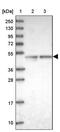 Armadillo Repeat Containing 6 antibody, PA5-59564, Invitrogen Antibodies, Western Blot image 